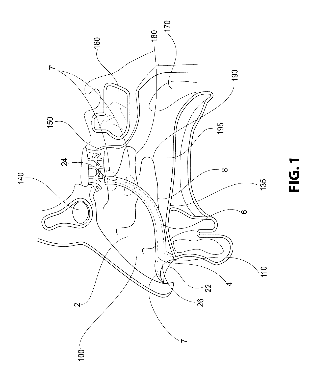 Nasal Device for Treatment