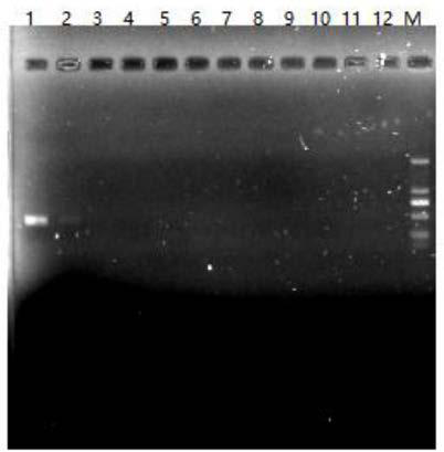 Specific primers for amplifying aedes albopictus Cytb gene and method for conducting sequencing by means of same