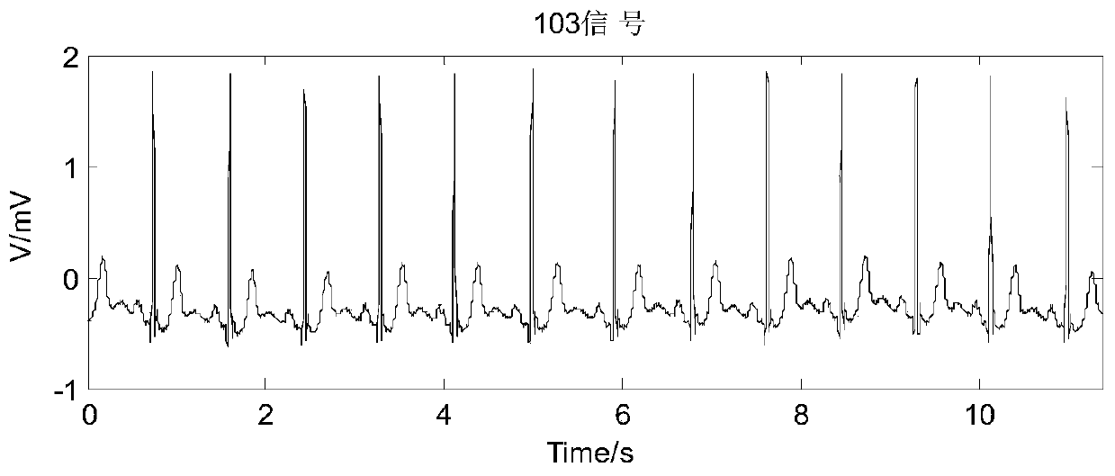 Integrated filtering method for ECG signals based on wavelet transform and improved EEMD