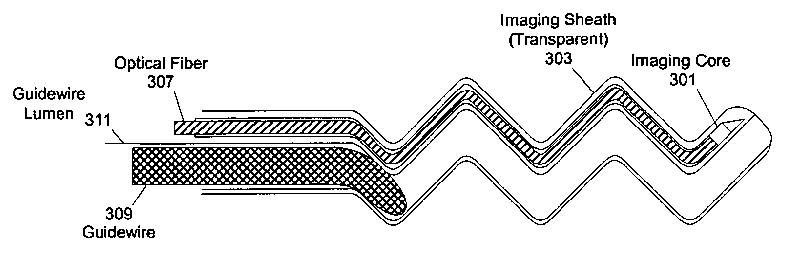 Methods and apparatuses for positioning within an internal channel