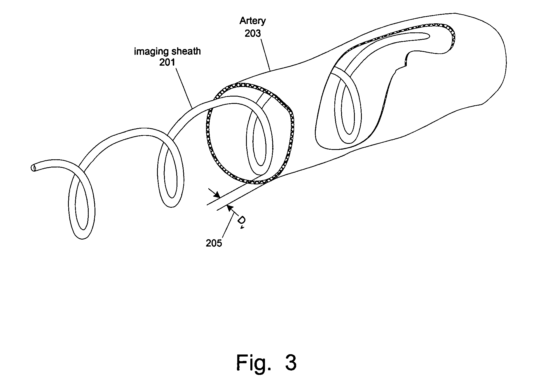 Methods and apparatuses for positioning within an internal channel