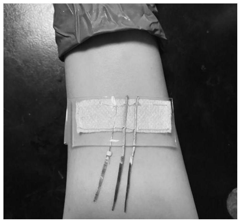 Preparation method of flexible wearable sweat glucose electrochemical sensor