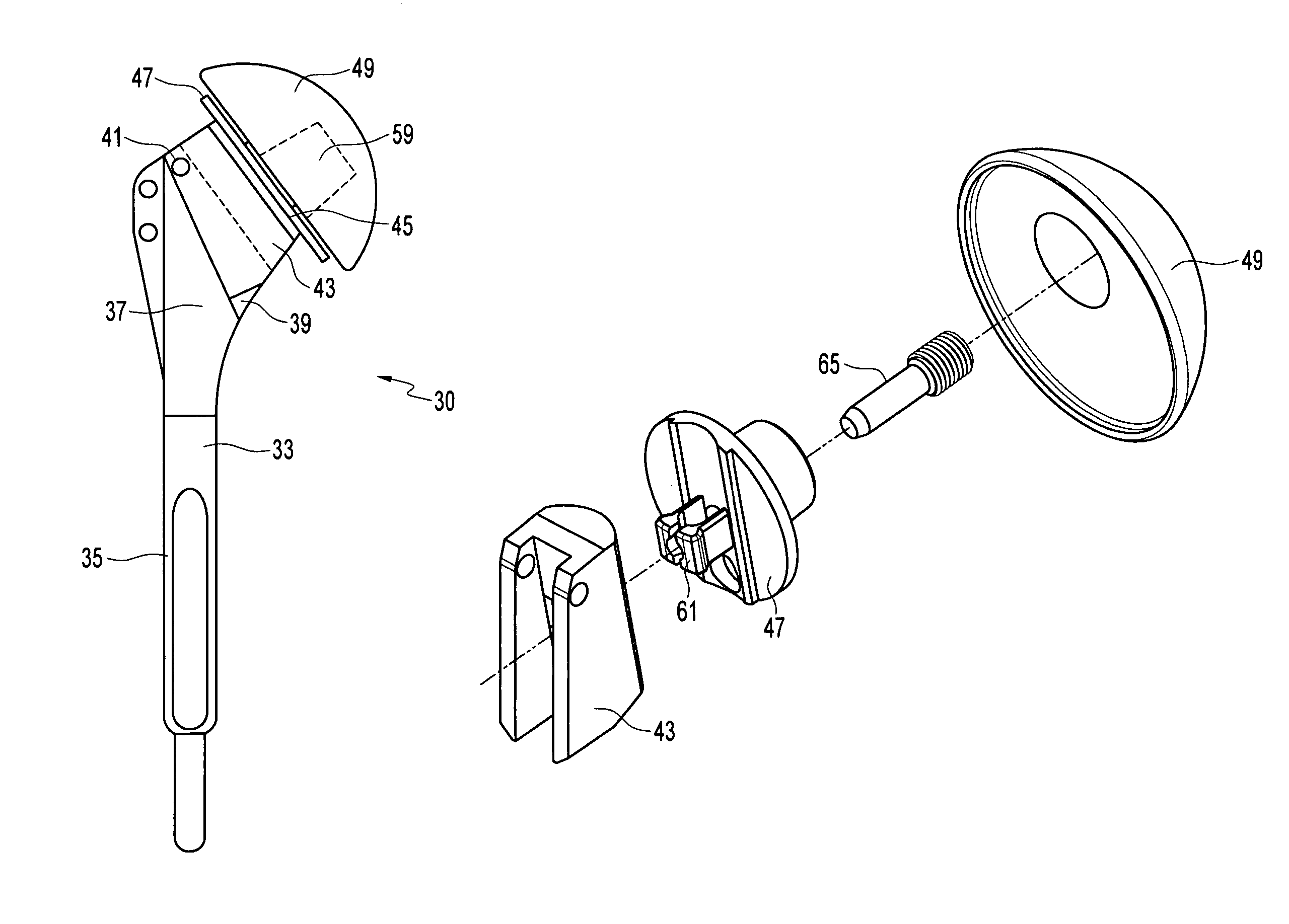 Shoulder prosthesis