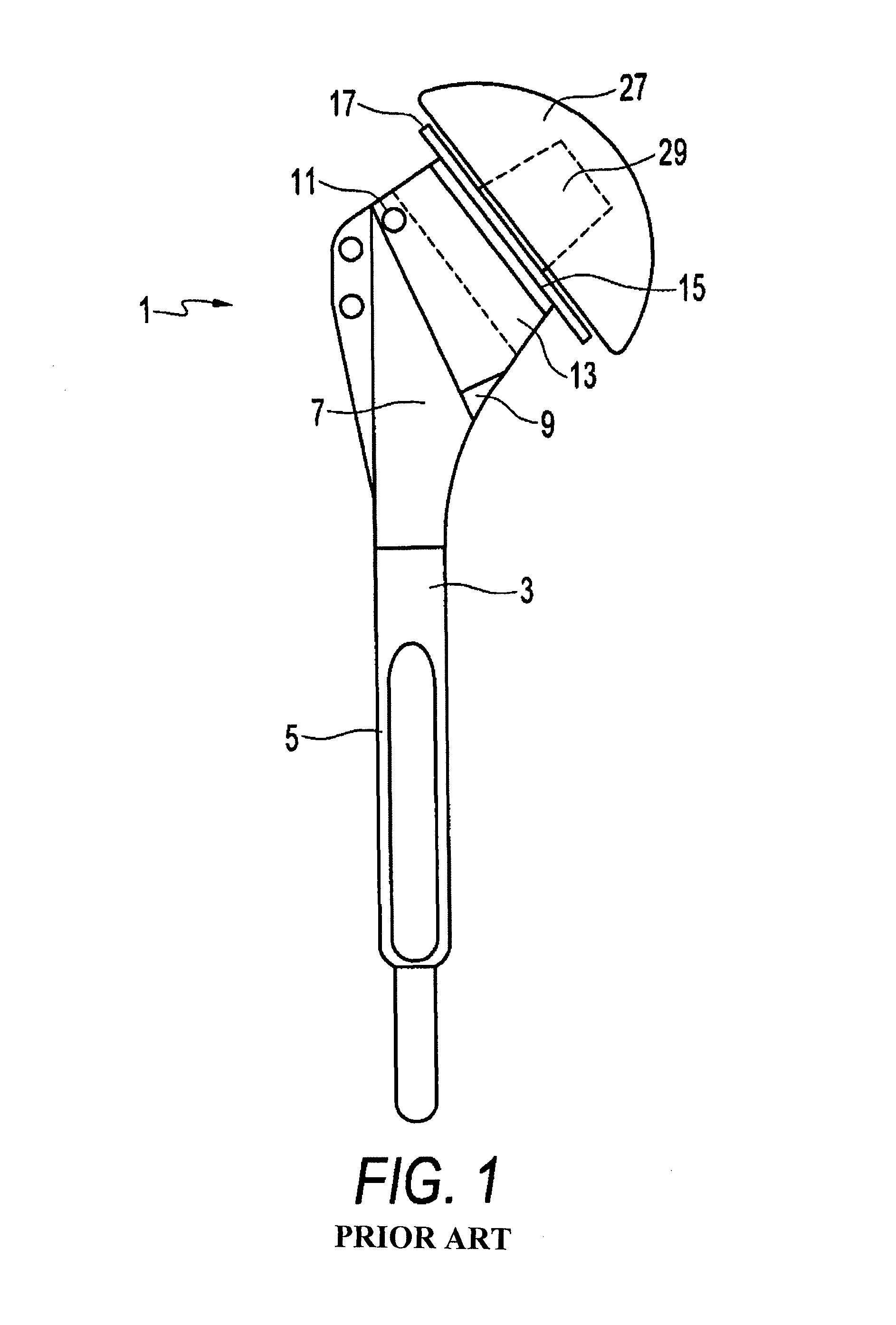 Shoulder prosthesis