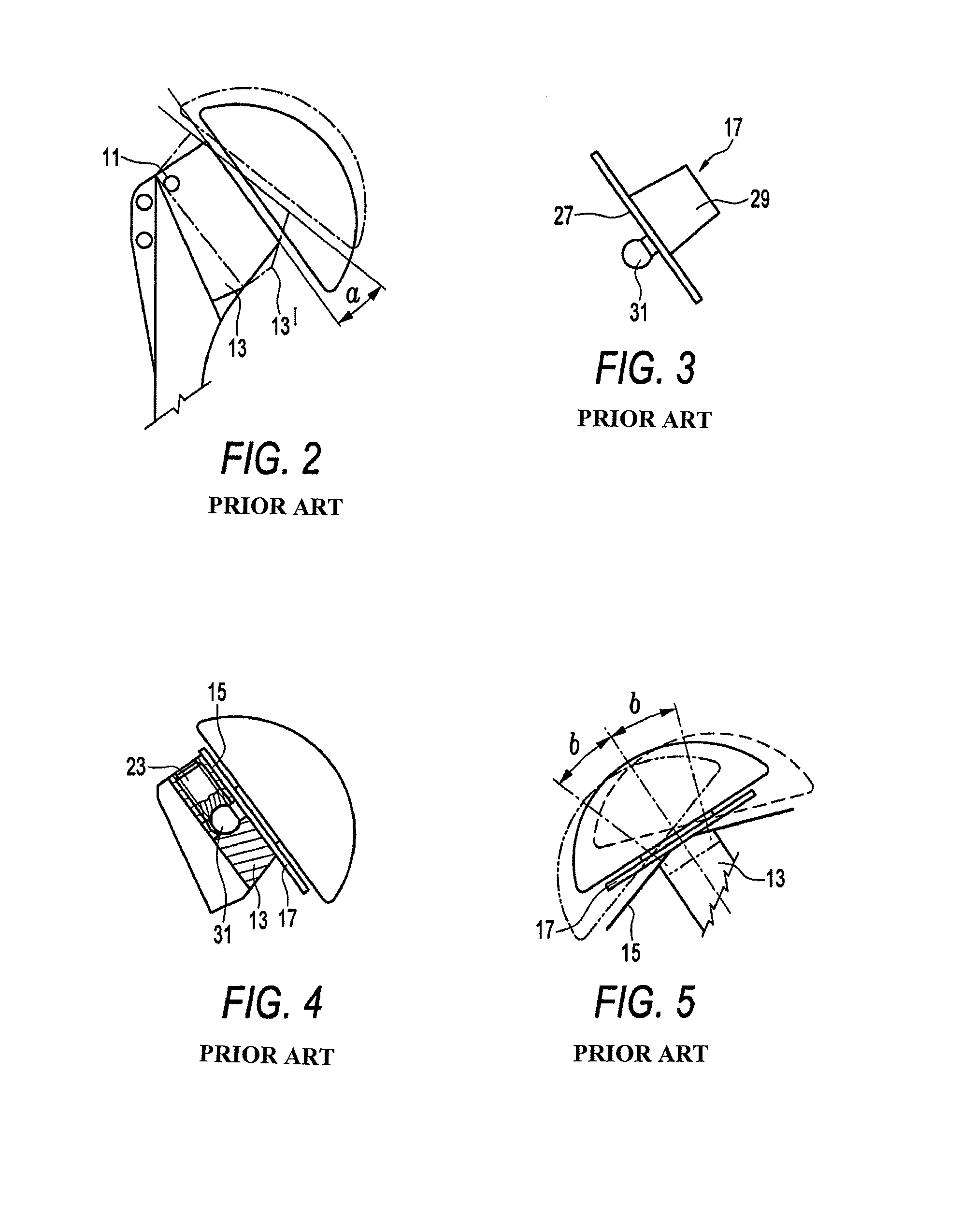 Shoulder prosthesis