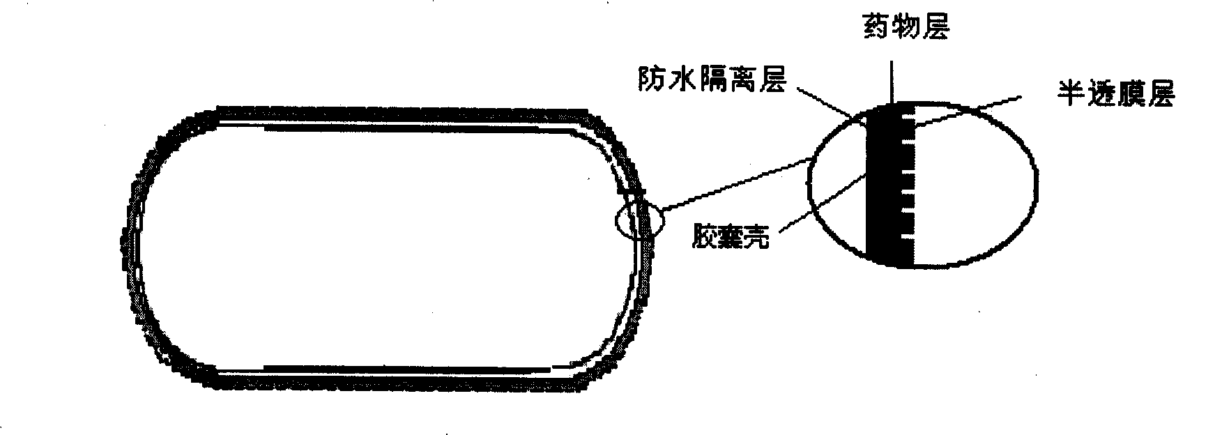 Stomach detention sustained and controlled release medicament releasing system and preparation method