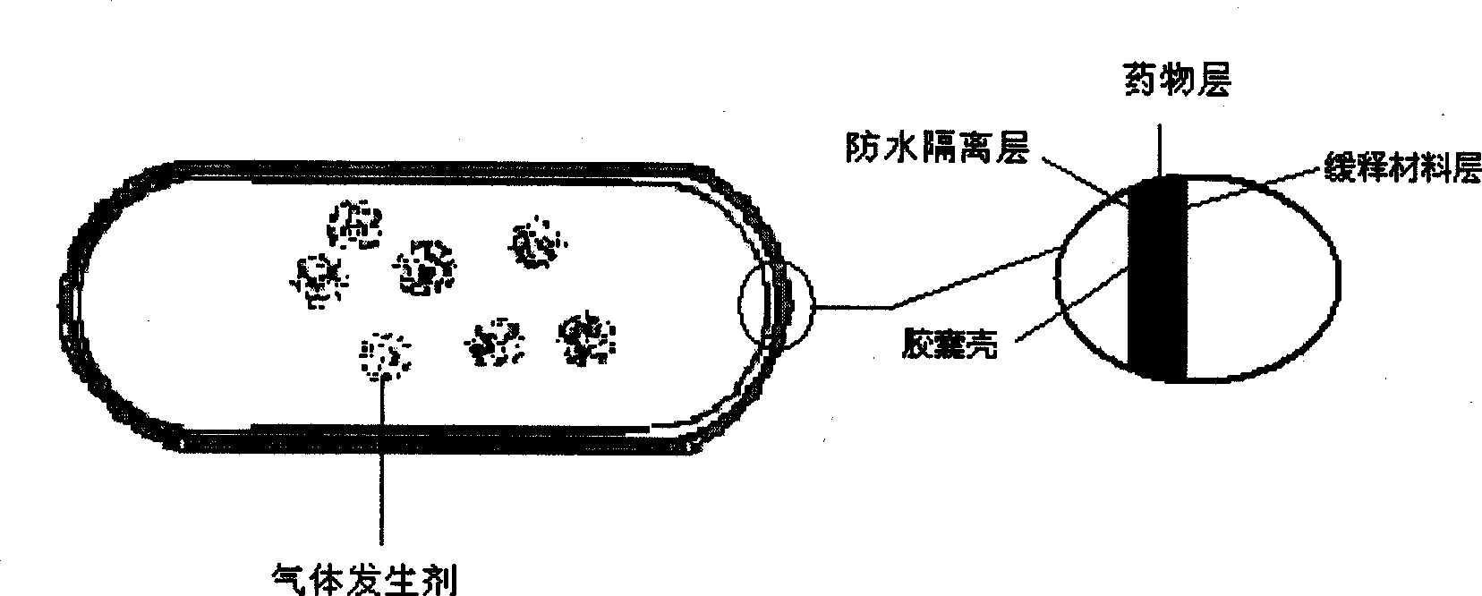 Stomach detention sustained and controlled release medicament releasing system and preparation method