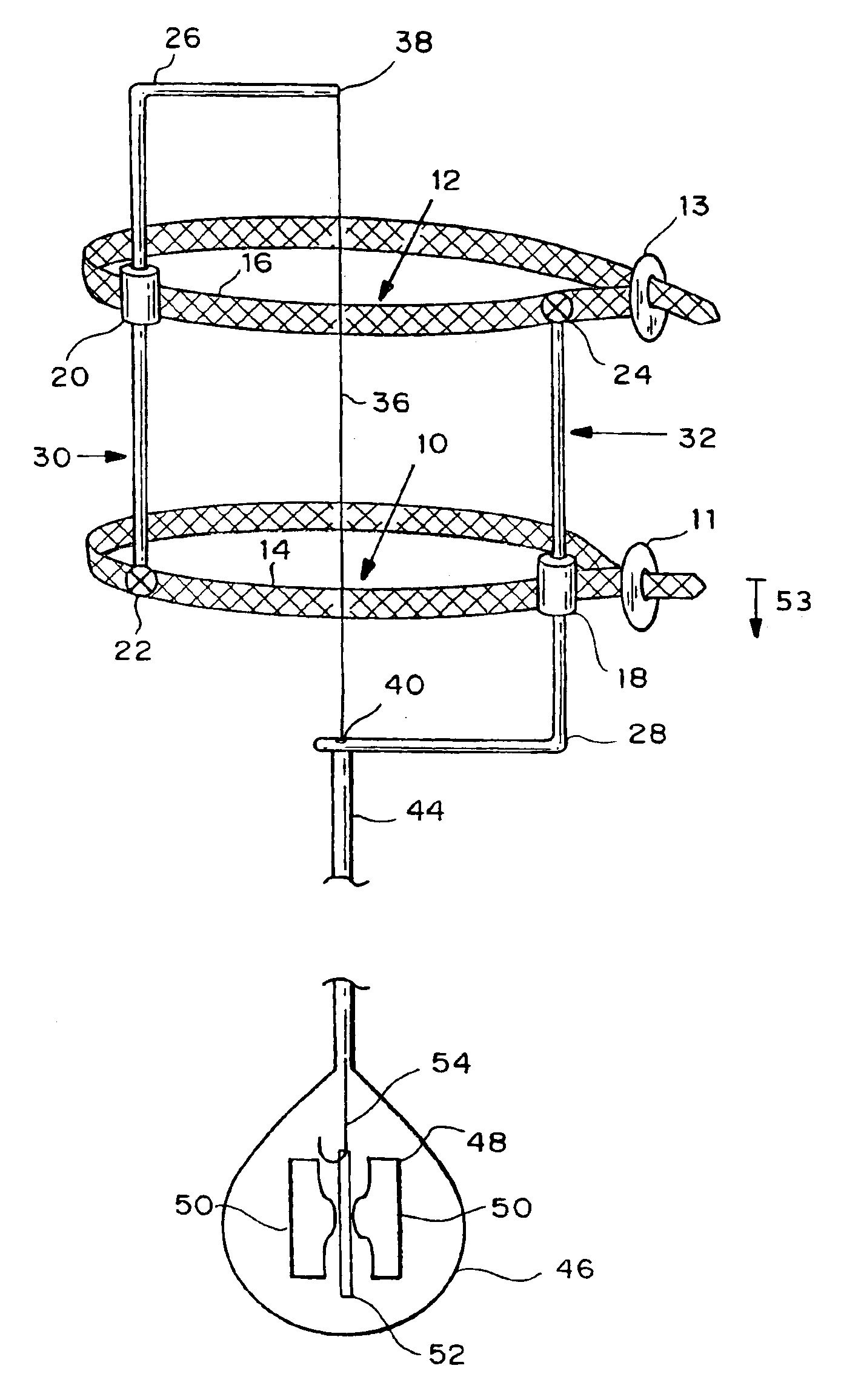 Autologous vascular grafts created by vessel distension