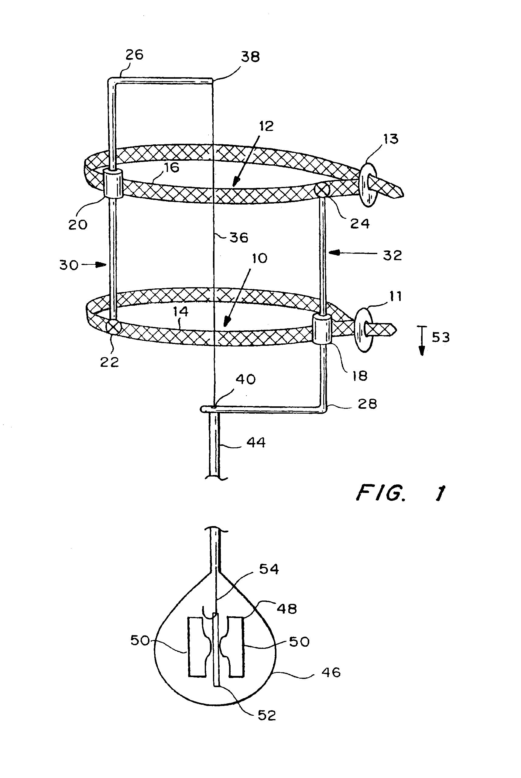 Autologous vascular grafts created by vessel distension