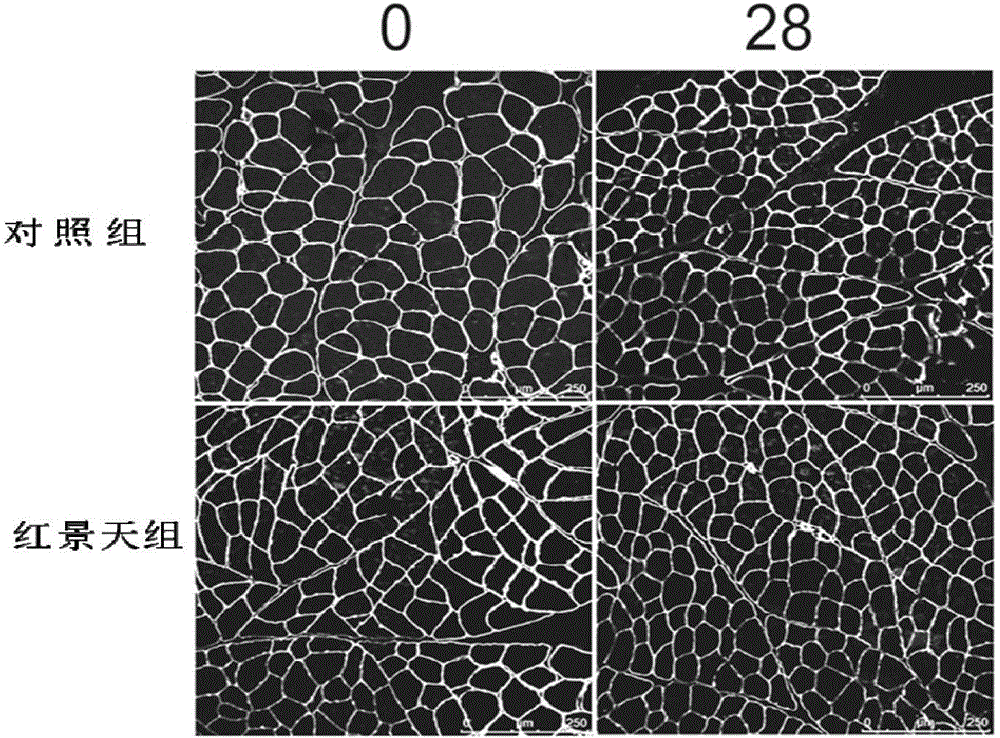 Application of rhodiola rosea in prevention and treatment of amyotrophy disease