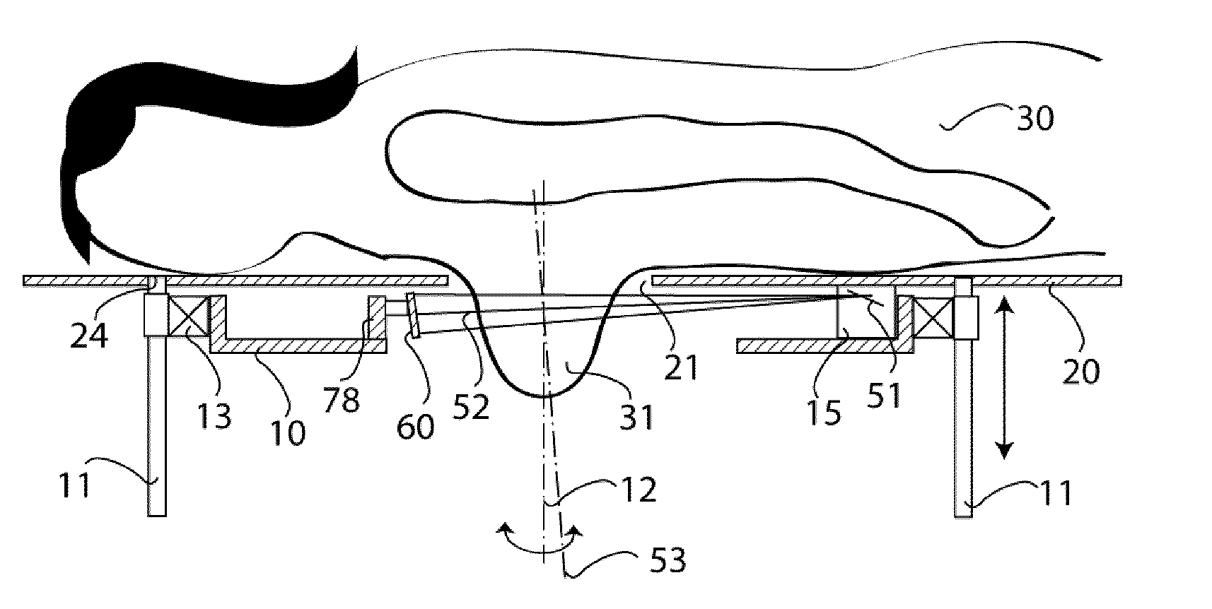 X-Ray Machine for Breast Examination Having a Beam Configuration for High Resolution Images