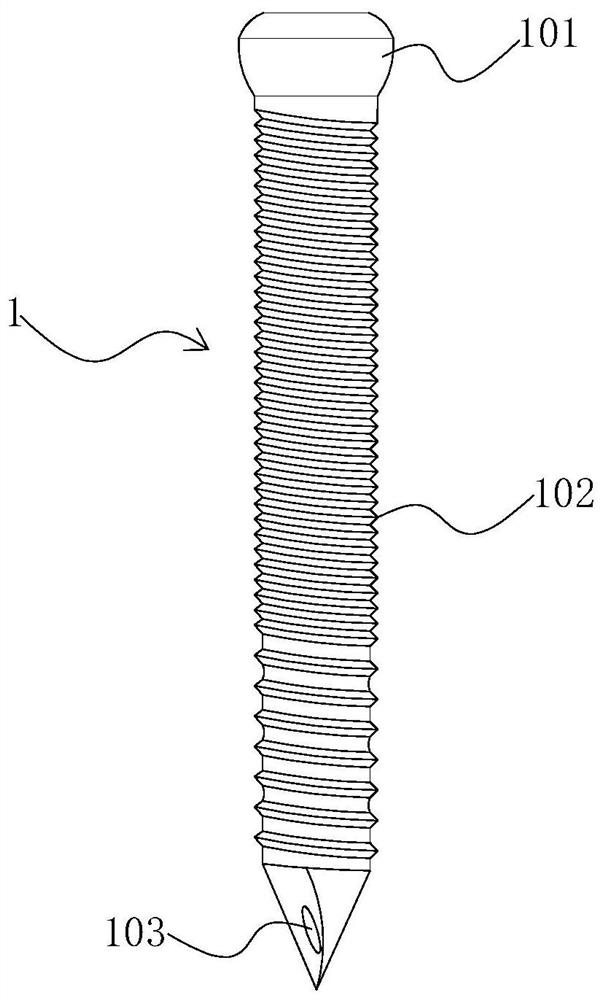 Bone cement fixation device and method