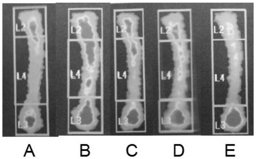 A preparation method of phosphorylated krill peptide capable of preventing and treating osteoporosis