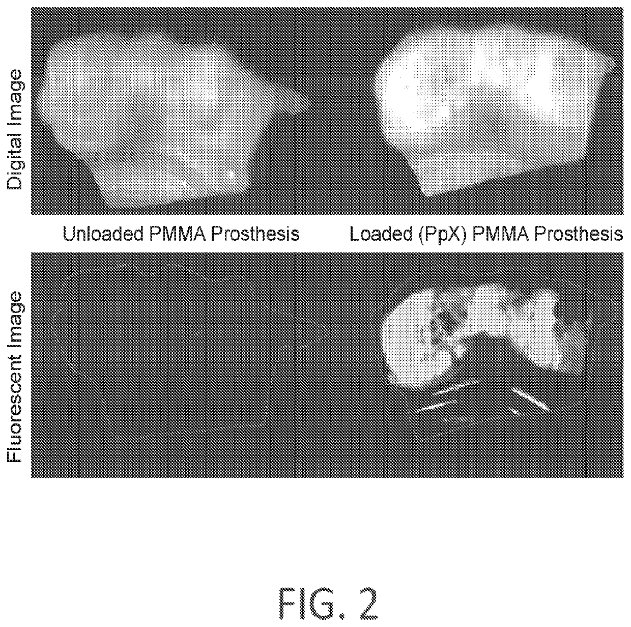 Functionalized prosthetic interfaces for the prevention and treatment of dental conditions