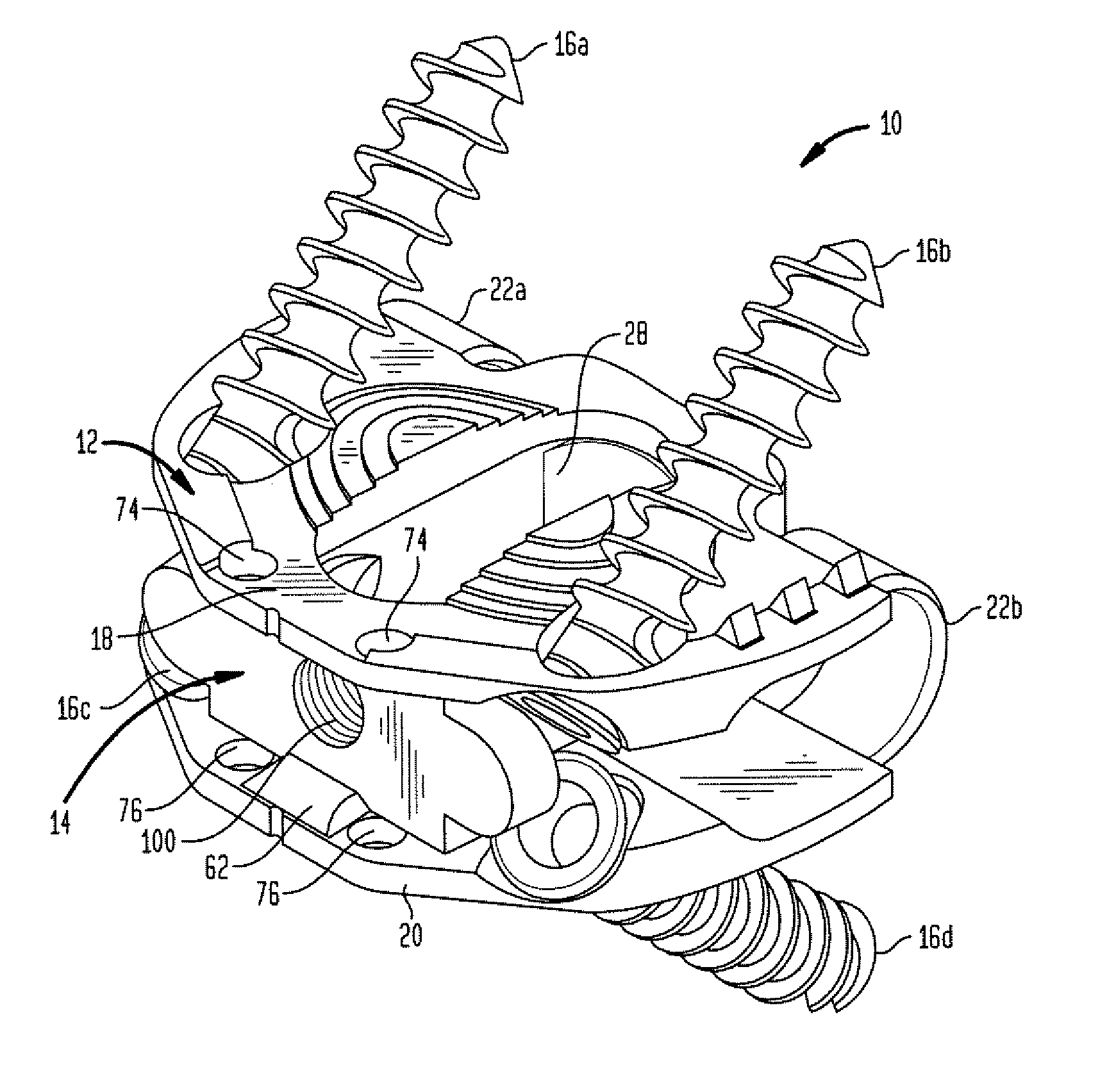 Stand alone anterior cage