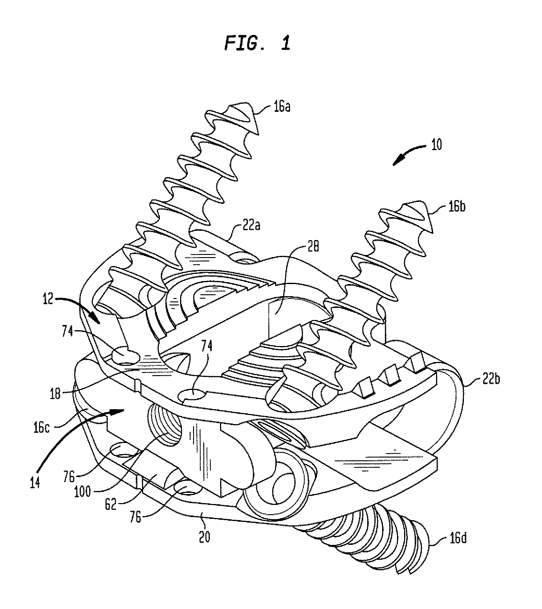 Stand alone anterior cage