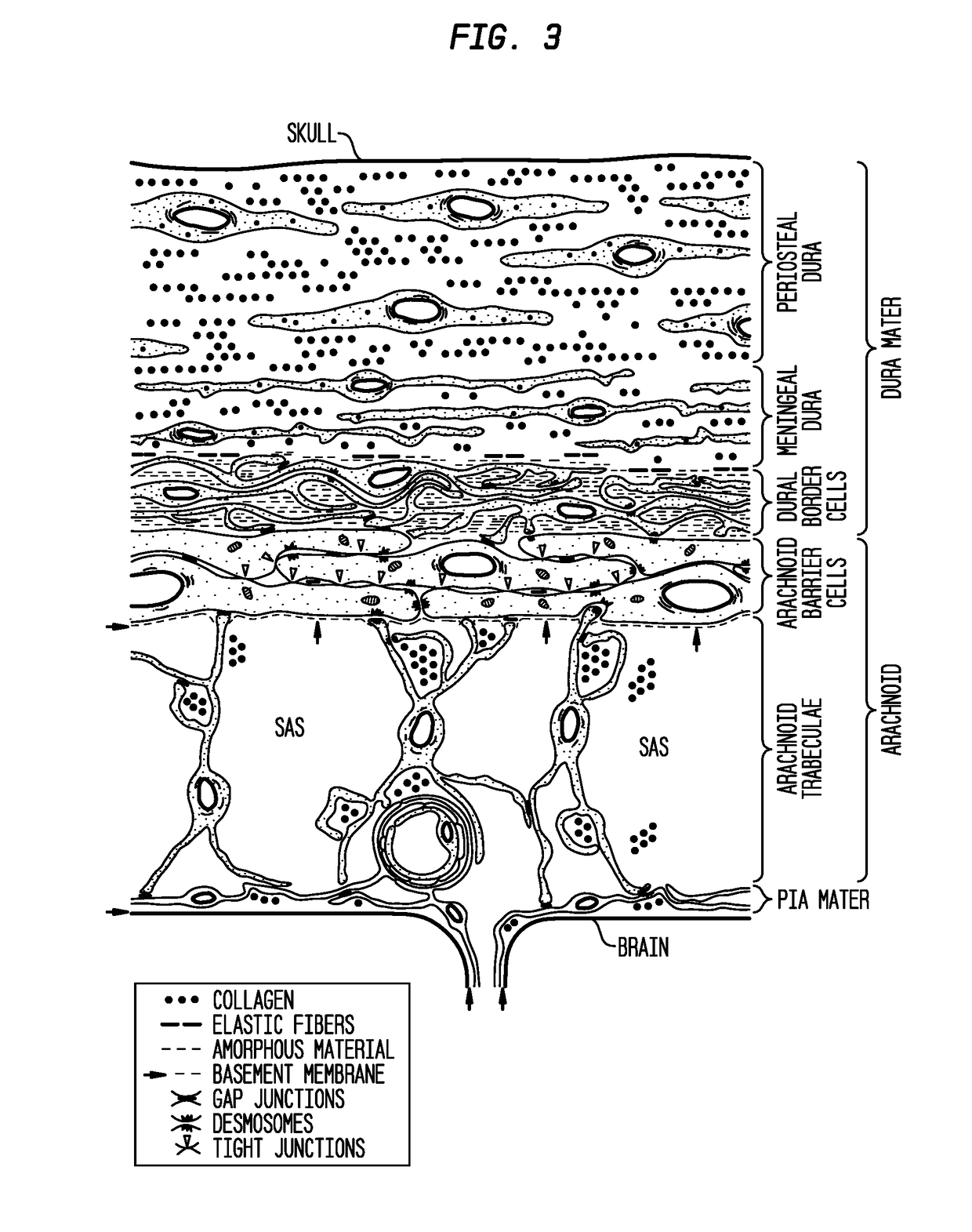 Formulations of site-specific, microparticulate compositions and their use to improve outcome after aneursymal subarachnoid hemorrhage