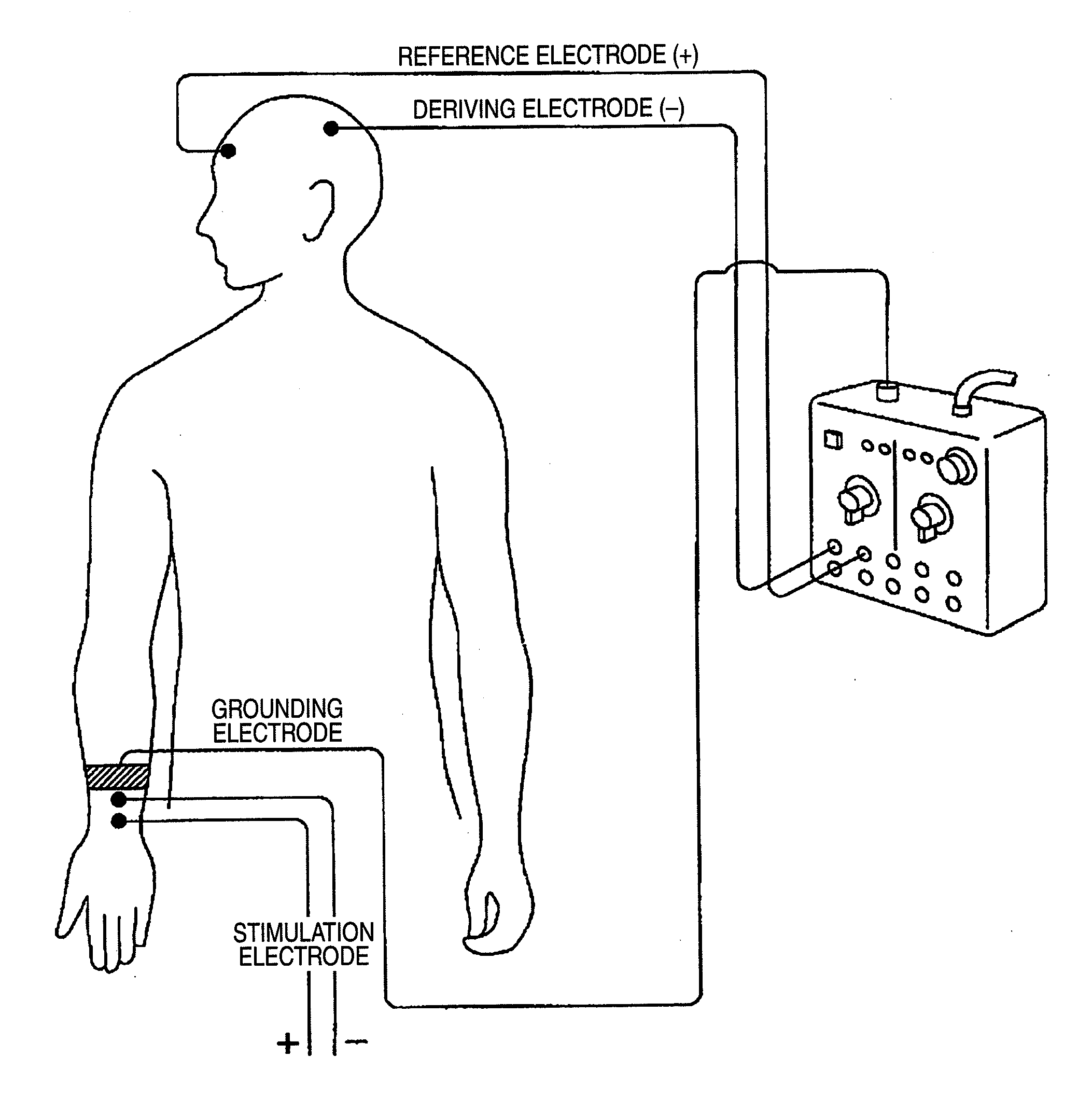 Pain sensory nerve stimulation apparatus