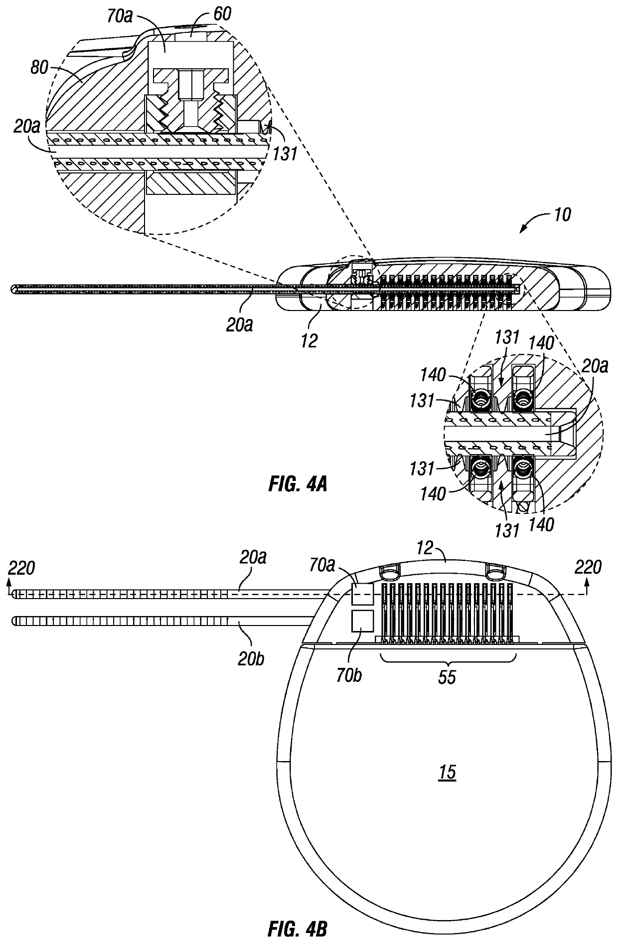 Apparatus and Device for the Electrical Interconnect of Implantable Devices