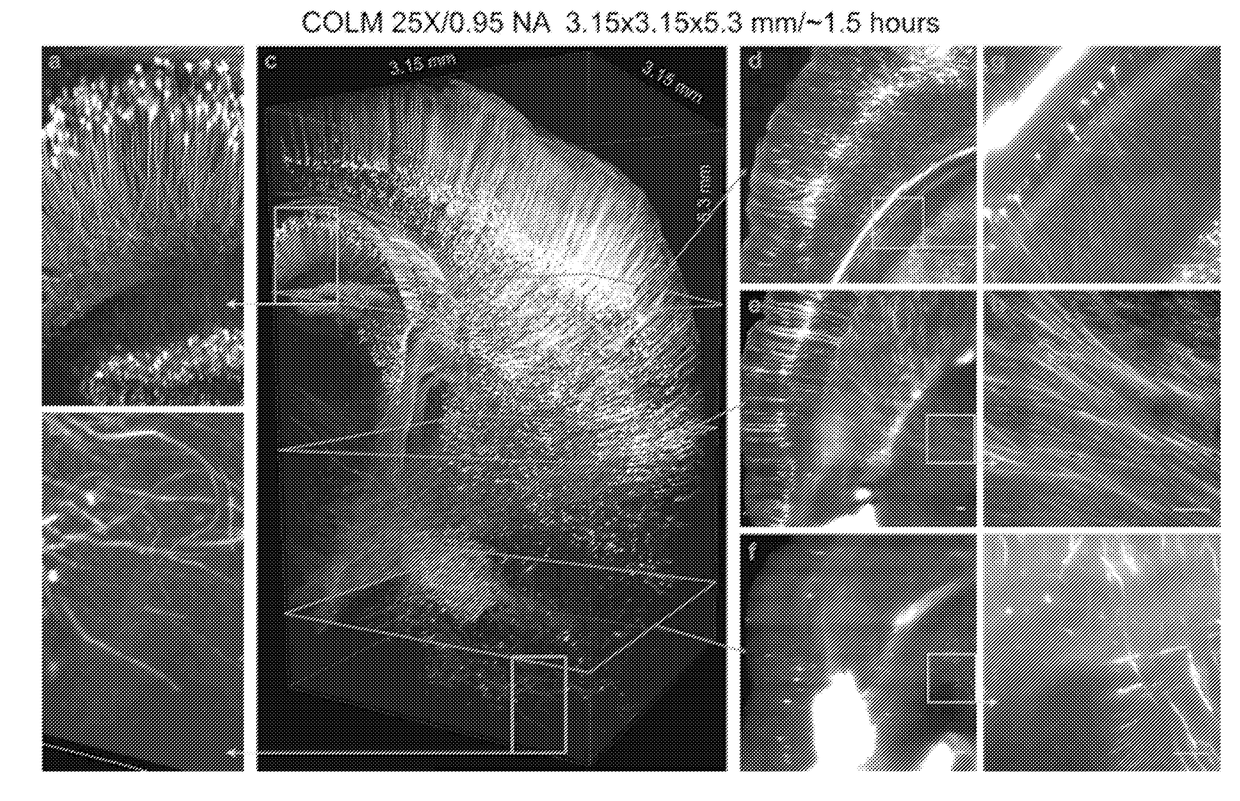 Methods and Devices for Imaging Large Intact Tissue Samples