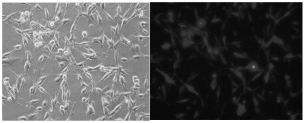 Construction method and application of breast cancer cell strain orthotopic transplantation model