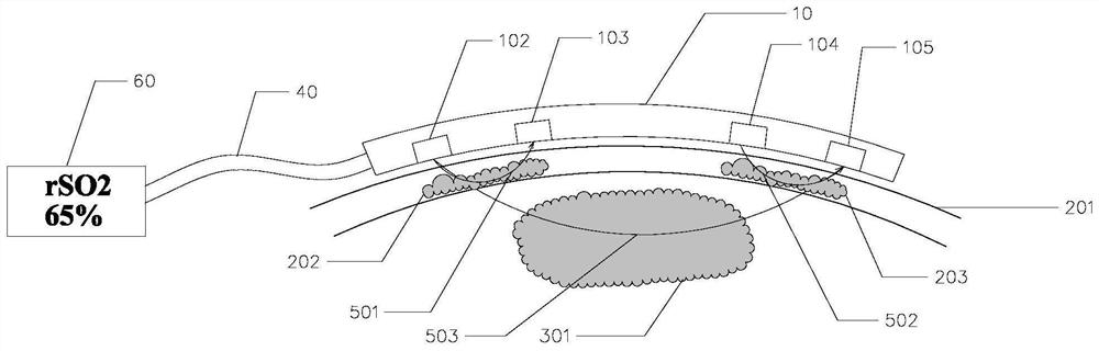 Brain blood oxygen saturation detection system and method free of scalp blood flow interference