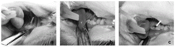 Combined drug for treating periodontitis