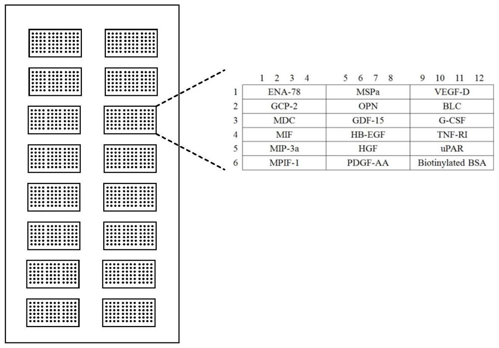 Leukemia marker joint detection antibody chip and kit