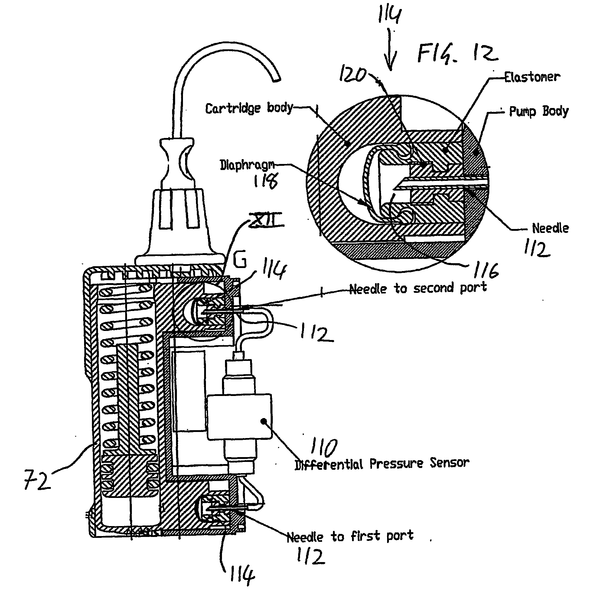 Drug delivery device and method