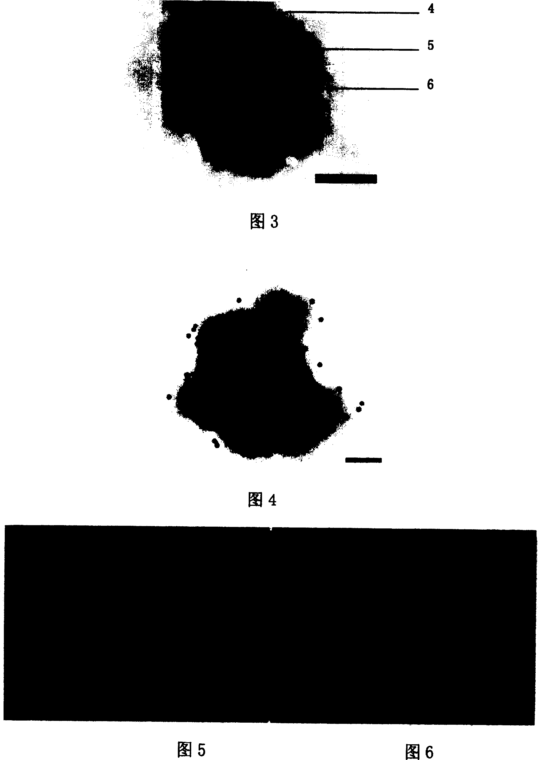 Monoclonal antibody of anti lymphocyst virus of and preparation method