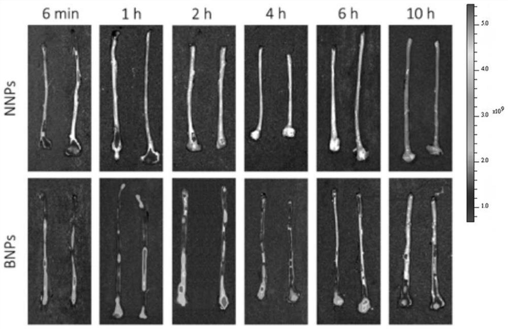 Bioadhesive nanoparticle for treating gastrointestinal diseases and preparation method of bioadhesive nanoparticle