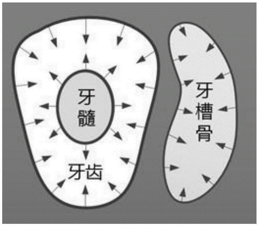 Hybrid level set based three-dimensional tooth modeling method