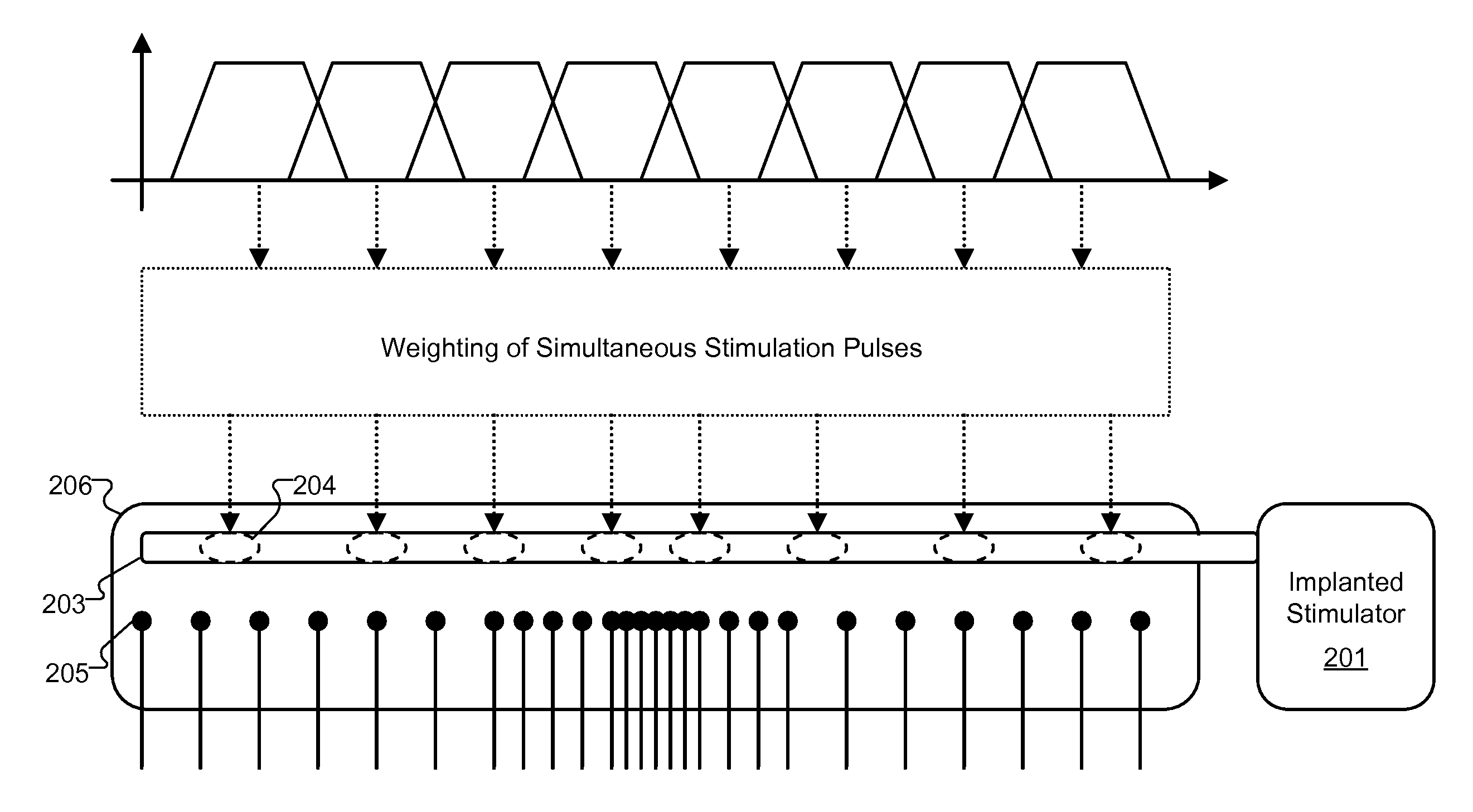 Tonotopic Implant Stimulation