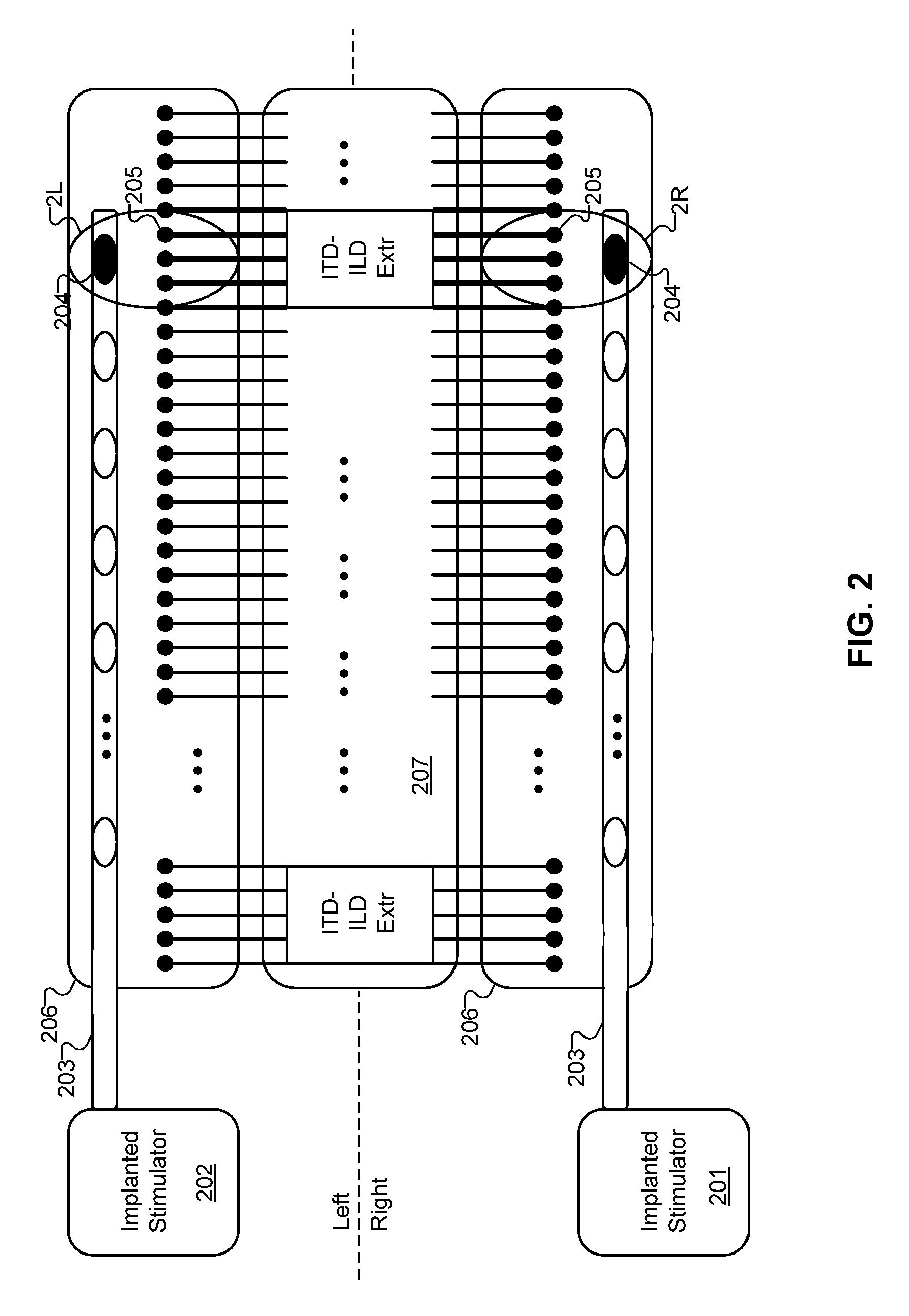 Tonotopic Implant Stimulation