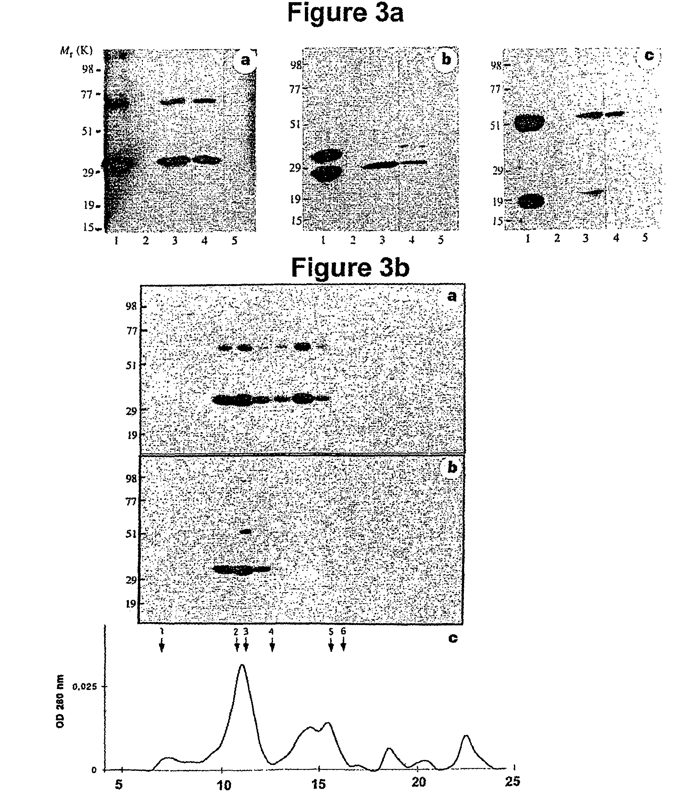 Masp-2, a complement-fixing enzyme, and uses for it