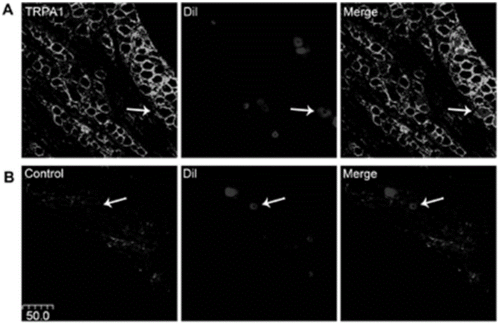 Use of bimatoprost as TRPA1 channel agonist in drug preparation