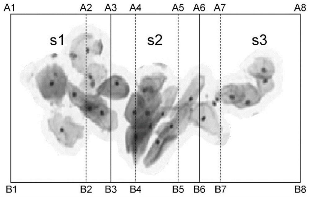 A method and system for segmenting diseased cells in cervical cytopathological slices