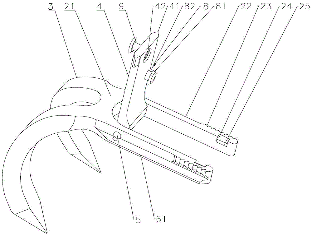 Patella Fixator