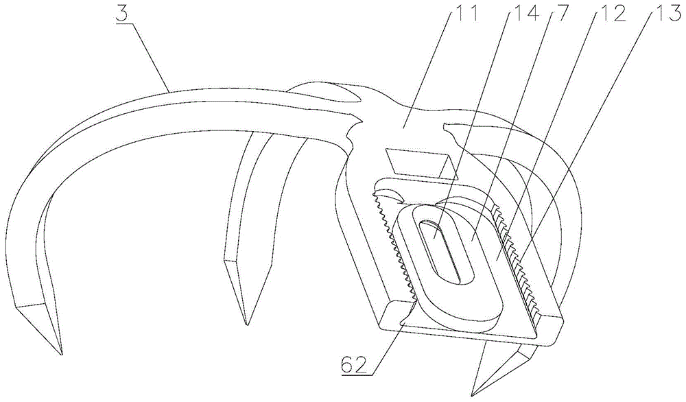 Patella Fixator