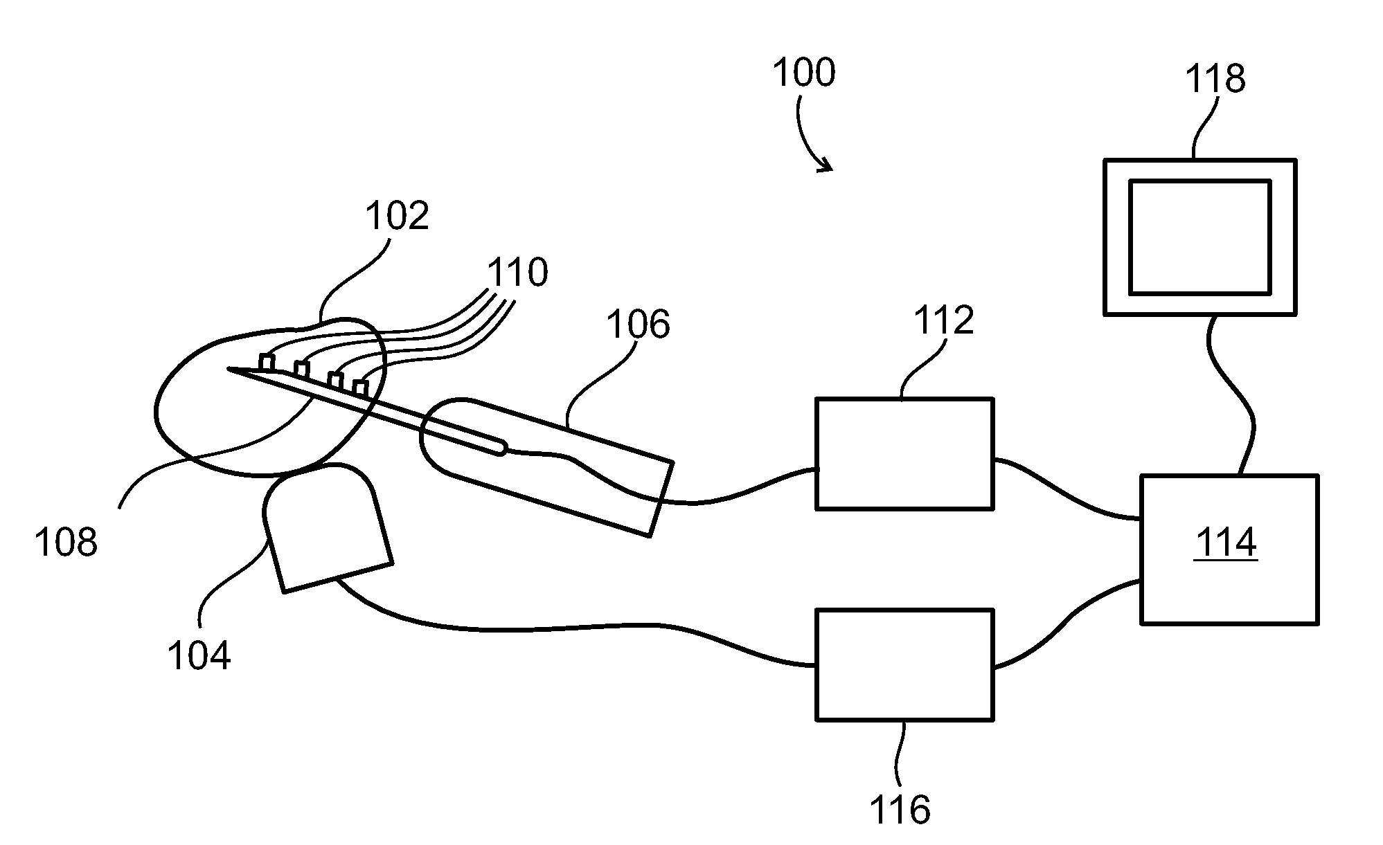 Method and system for tissue recognition