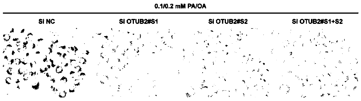 Application of otub2 and its inhibitors in the preparation of drugs for the treatment of fatty liver and related diseases