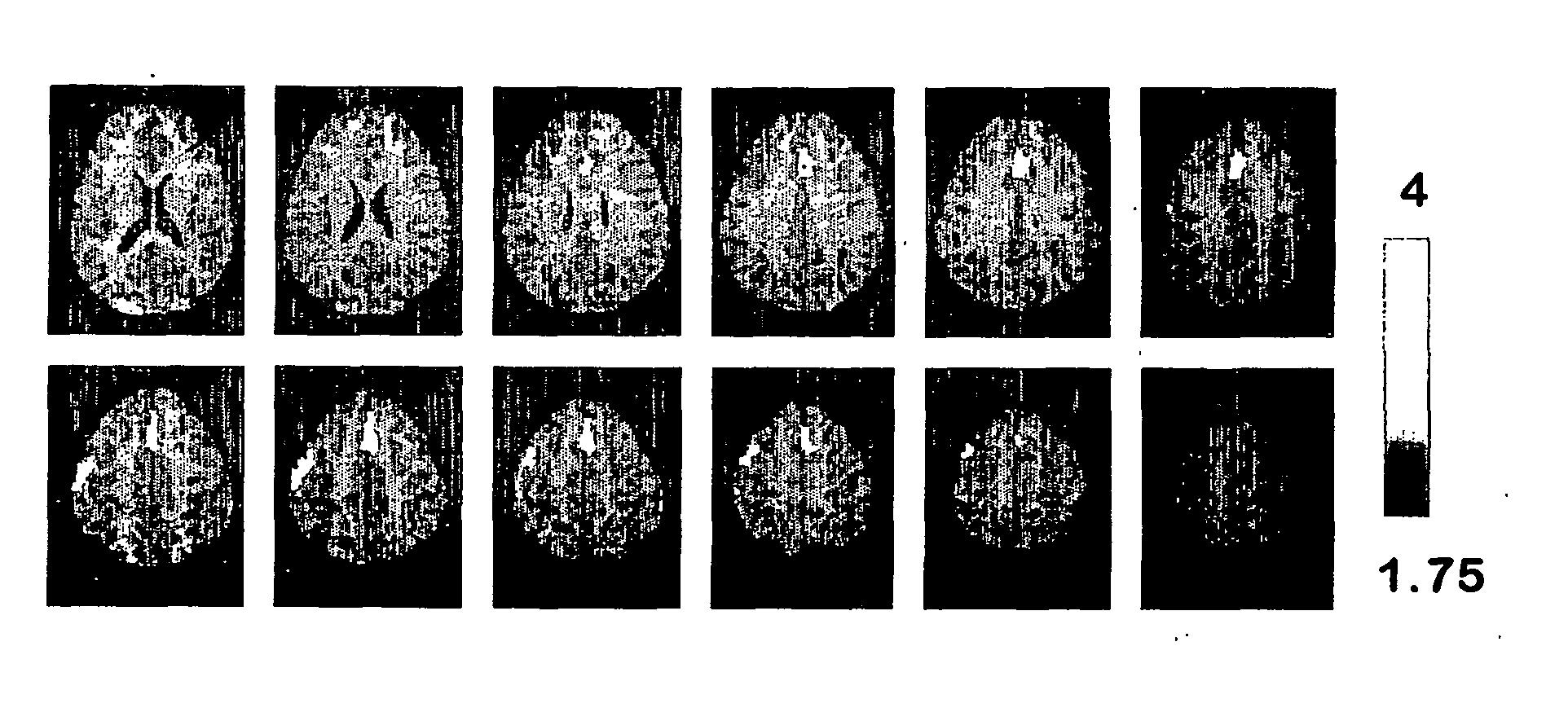 Functional brain imaging for detecting and assessing deception and concealed recognition, and cognitive/emotional response to information