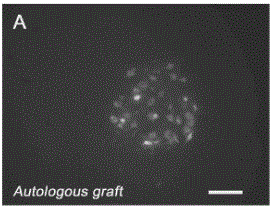 RAPA-PLGA scaffold