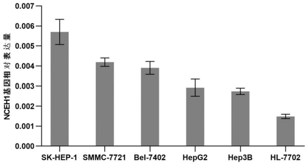 SiRNA, siRNA plasmid and lentivirus for targeted inhibition of neutral cholesteryl ester hydrolase 1 (NCEH1) gene expression, and construction methods and application of SiRNA, siRNA plasmid and lentivirus