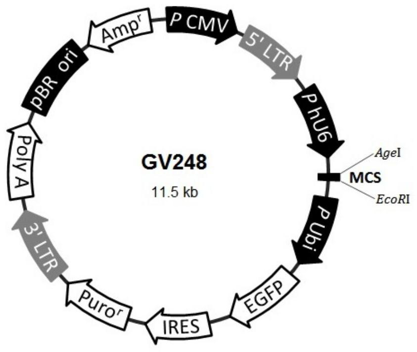 SiRNA, siRNA plasmid and lentivirus for targeted inhibition of neutral cholesteryl ester hydrolase 1 (NCEH1) gene expression, and construction methods and application of SiRNA, siRNA plasmid and lentivirus