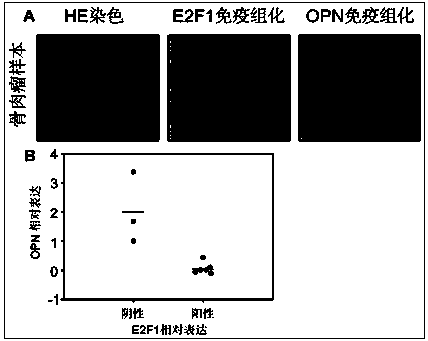 Application of E2F1 protein in preparation of medicine for diagnosing and treating osteosarcoma