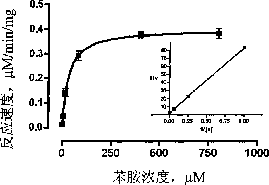 Use of tiopronin in preparing medicament for treating liver function damage induced by cerebral ischemia, diabetes and obesity