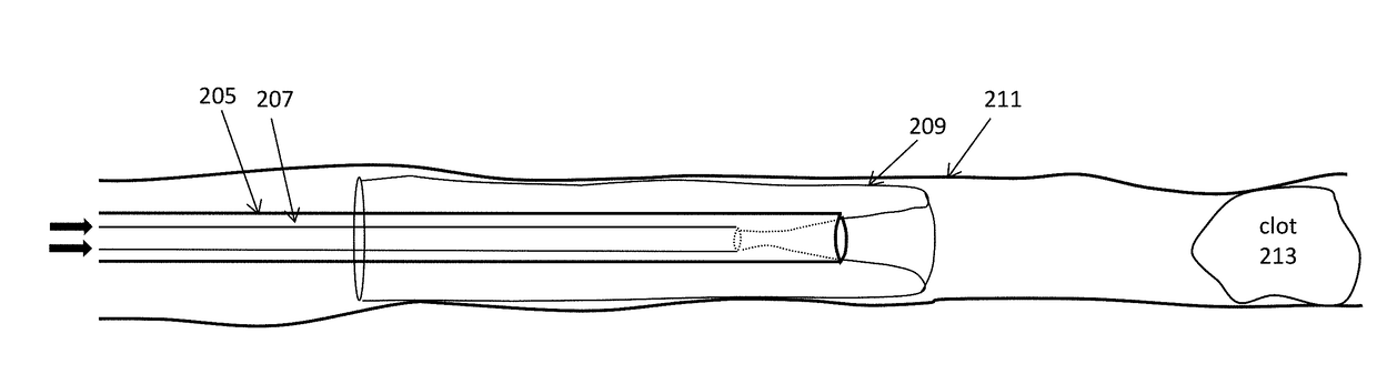 Methods for advancing inverting mechanical thrombectomy apparatuses in the vasculature