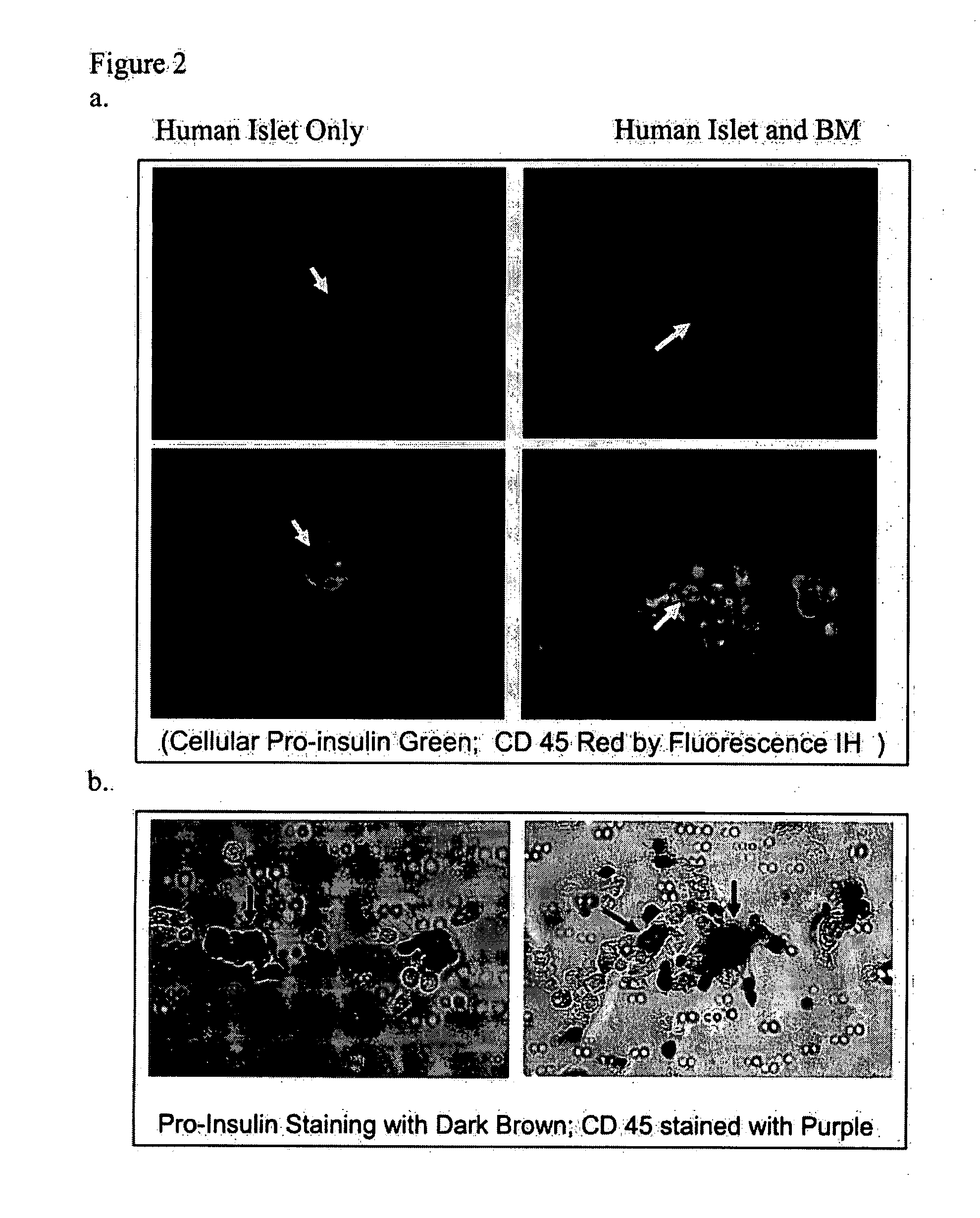 Use of bone marrow cells for long term culture of pancreatic islet cells