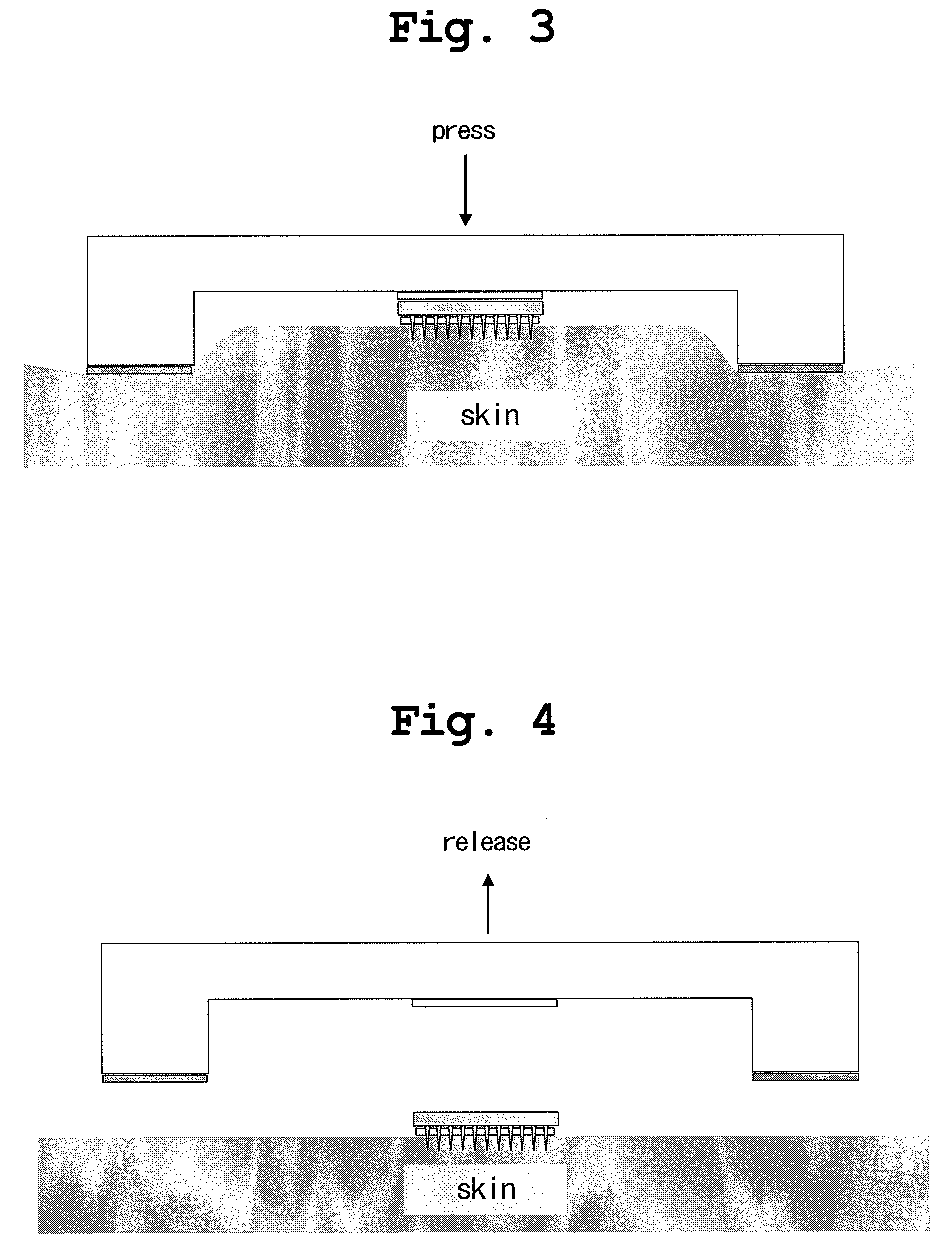 Applicator for microneedle array